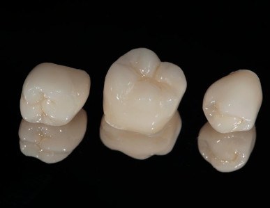 Dental crowns