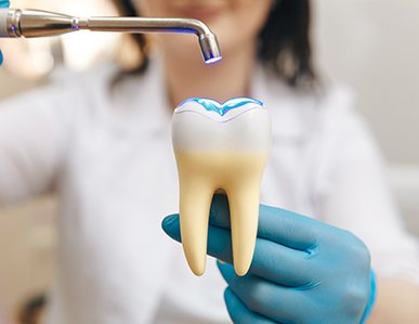 Dentist demonstrating tooth-colored filling on large model tooth